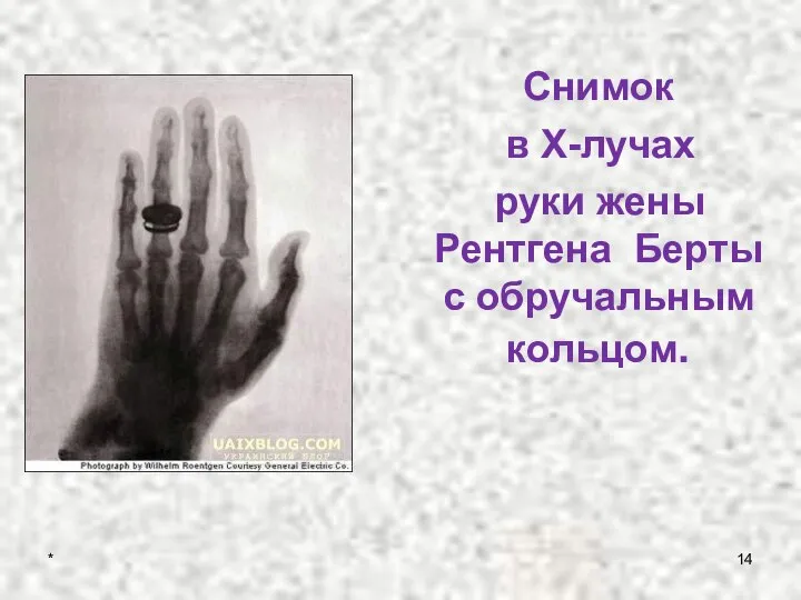 Снимок в Х-лучах руки жены Рентгена Берты с обручальным кольцом. *