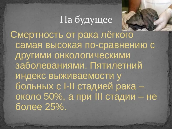 Смертность от рака лёгкого самая высокая по-сравнению с другими онкологическими заболеваниями.