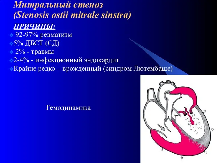 Митральный стеноз (Stenosis ostii mitrale sinstra) ПРИЧИНЫ: 92-97% ревматизм 5% ДБСТ