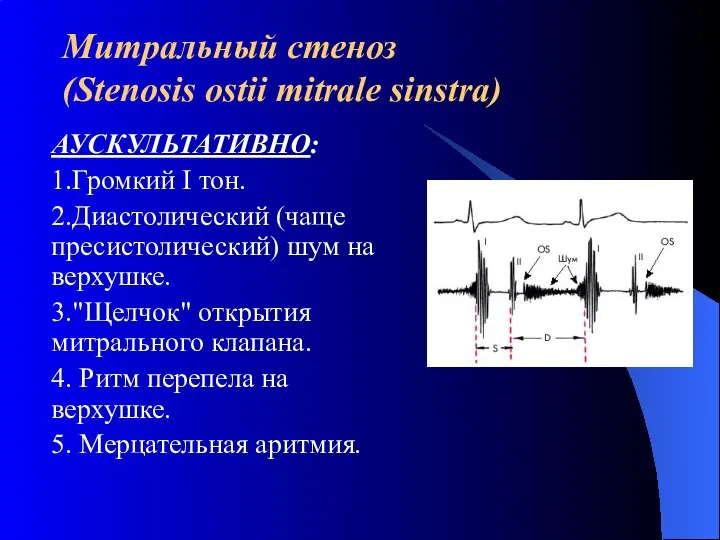 Митральный стеноз (Stenosis ostii mitrale sinstra) АУСКУЛЬТАТИВНО: 1.Громкий I тон. 2.Диастолический