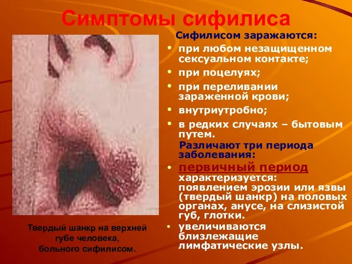 Симптомы сифилиса Сифилисом заражаются: при любом незащищенном сексуальном контакте; при поцелуях;