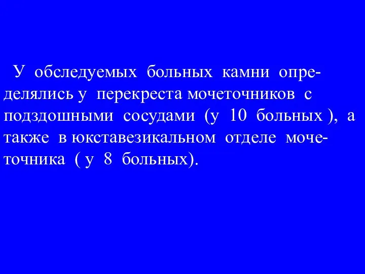 У обследуемых больных камни опре-делялись у перекреста мочеточников с подздошными сосудами