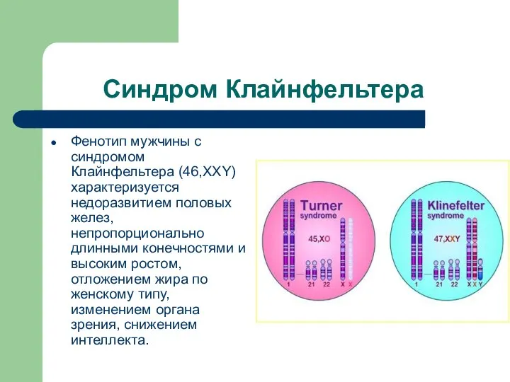 Синдром Клайнфельтера Фенотип мужчины с синдромом Клайнфельтера (46,ХХY) характеризуется недоразвитием половых