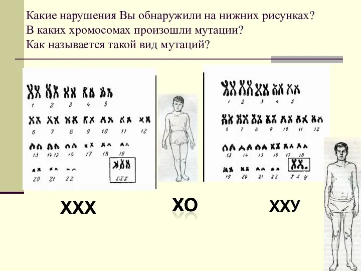 Какие нарушения Вы обнаружили на нижних рисунках? В каких хромосомах произошли