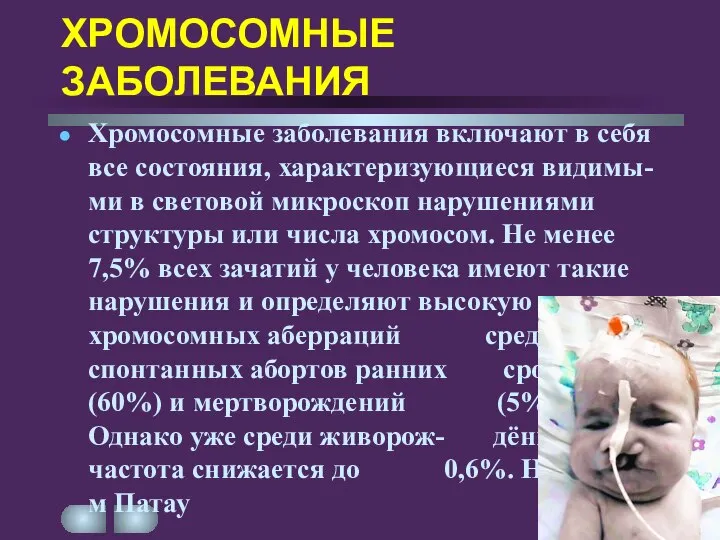 ХРОМОСОМНЫЕ ЗАБОЛЕВАНИЯ Хромосомные заболевания включают в себя все состояния, характеризующиеся видимы-ми