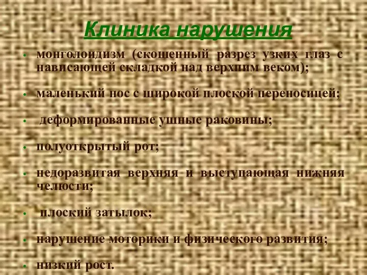 Клиника нарушения монголоидизм (скошенный разрез узких глаз с нависающей складкой над