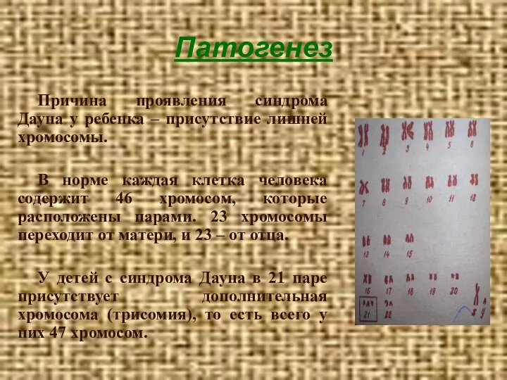 Патогенез Причина проявления синдрома Дауна у ребенка – присутствие лишней хромосомы.