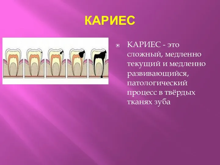 КАРИЕС КАРИЕС - это сложный, медленно текущий и медленно развивающийся, патологический процесс в твёрдых тканях зуба