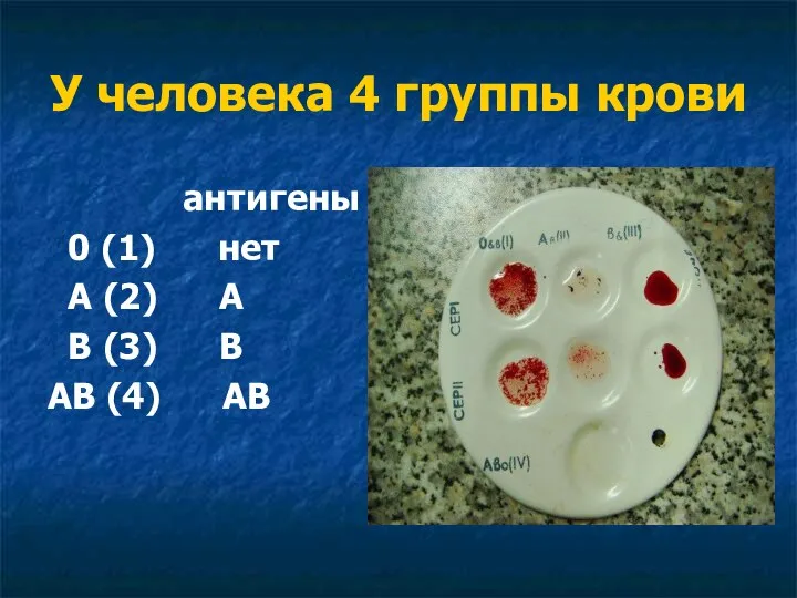 У человека 4 группы крови антигены 0 (1) нет А (2)