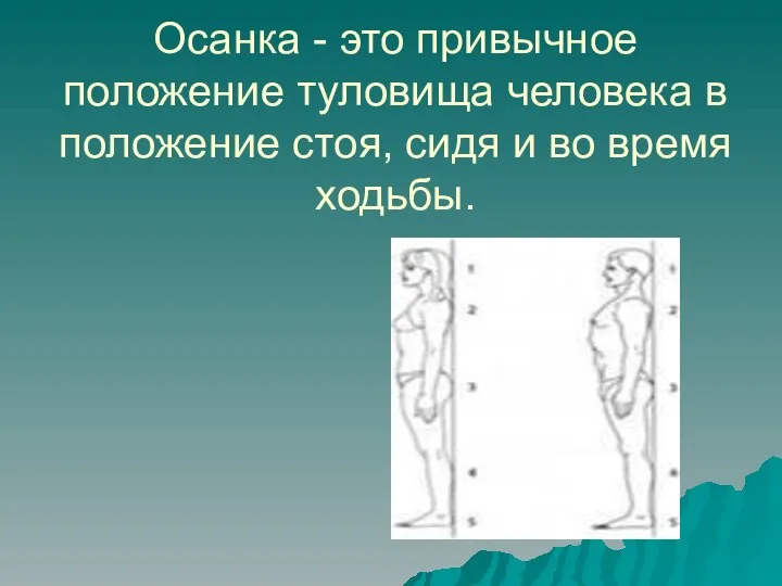 Осанка - это привычное положение туловища человека в положение стоя, сидя и во время ходьбы.