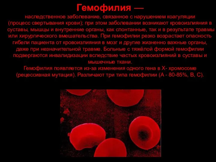 Гемофилия — наследственное заболевание, связанное с нарушением коагуляции (процесс свертывания крови);