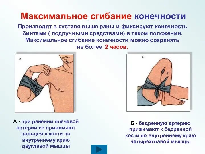 Максимальное сгибание конечности Производят в суставе выше раны и фиксируют конечность