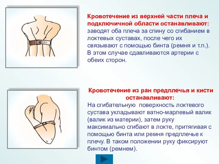 Кровотечение из верхней части плеча и подключичной области останавливают: заводят оба