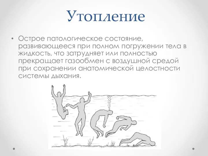 Утопление Острое патологическое состояние, развивающееся при полном погружении тела в жидкость,