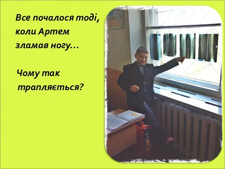 Все почалося тоді, коли Артем зламав ногу… Чому так трапляється?