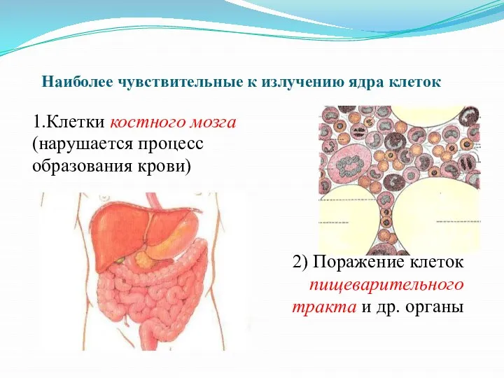 Наиболее чувствительные к излучению ядра клеток 1.Клетки костного мозга (нарушается процесс