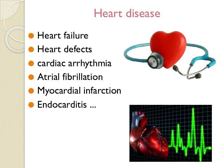 Heart disease Heart failure Heart defects cardiac arrhythmia Atrial fibrillation Myocardial infarction Endocarditis ...