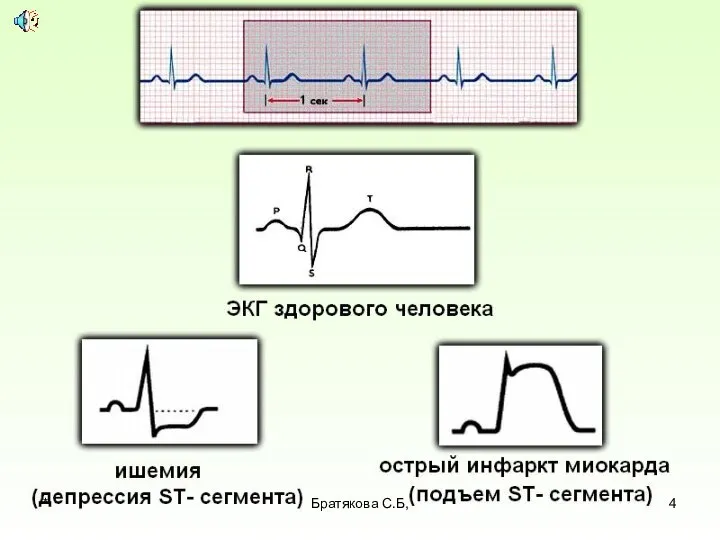 * Братякова С.Б,