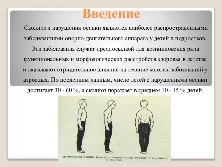 Введение Сколиоз и нарушения осанки являются наиболее распространенными заболеваниями опорно-двигательного аппарата