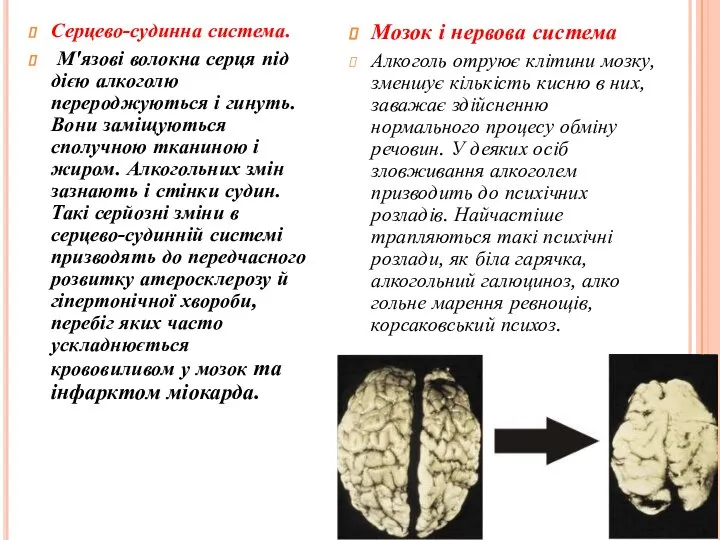 Мозок і нервова система Алкоголь отруює клітини мозку, зменшує кількість кисню