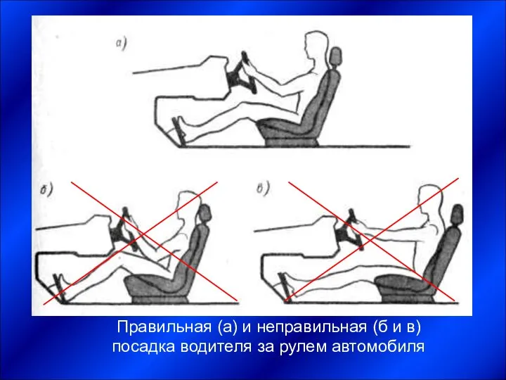 Правильная (а) и неправильная (б и в) посадка водителя за рулем автомобиля