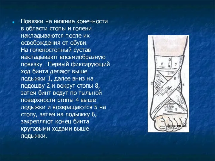 Повязки на нижние конечности в области стопы и голени накладываются после