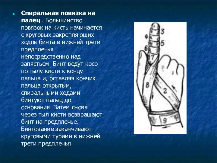 Спиральная повязка на палец . Большинство повязок на кисть начинается с