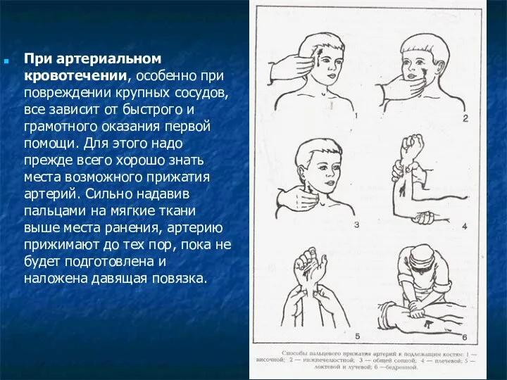 При артериальном кровотечении, особенно при повреждении крупных сосудов, все зависит от