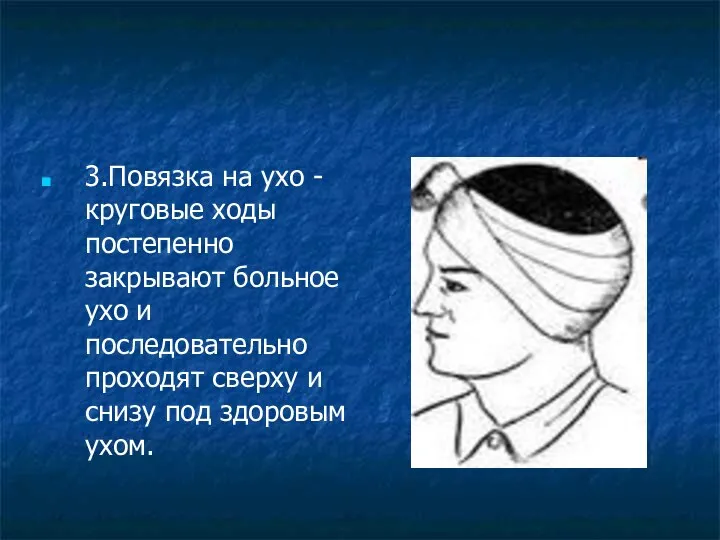 3.Повязка на ухо - круговые ходы постепенно закрывают больное ухо и