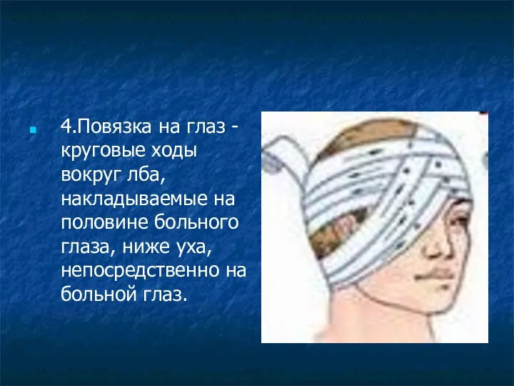 4.Повязка на глаз - круговые ходы вокруг лба, накладываемые на половине