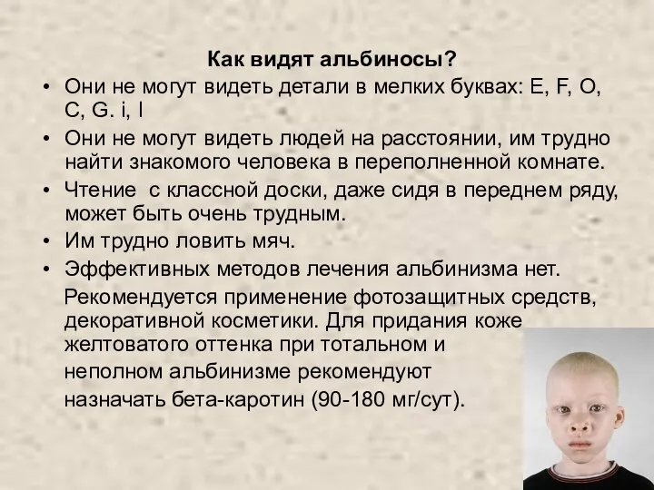 Как видят альбиносы? Они не могут видеть детали в мелких буквах: