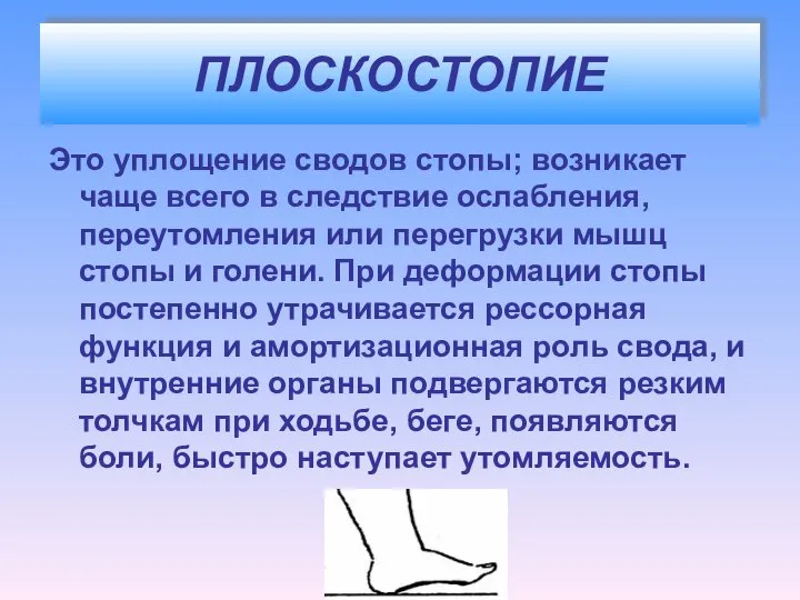 ПЛОСКОСТОПИЕ Это уплощение сводов стопы; возникает чаще всего в следствие ослабления,