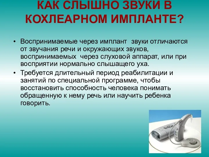 КАК СЛЫШНО ЗВУКИ В КОХЛЕАРНОМ ИМПЛАНТЕ? Воспринимаемые через имплант звуки отличаются