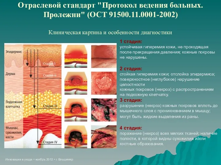 Инновации в уходе • ноябрь 2012 • г. Владимир Отраслевой стандарт