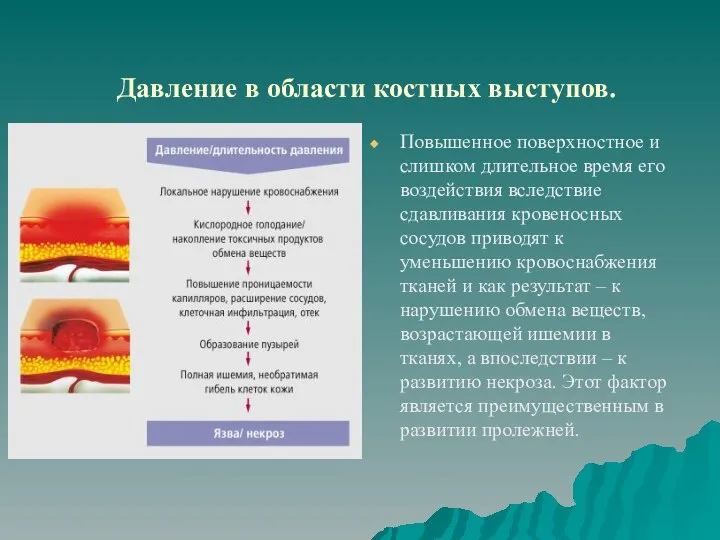 Давление в области костных выступов. Повышенное поверхностное и слишком длительное время