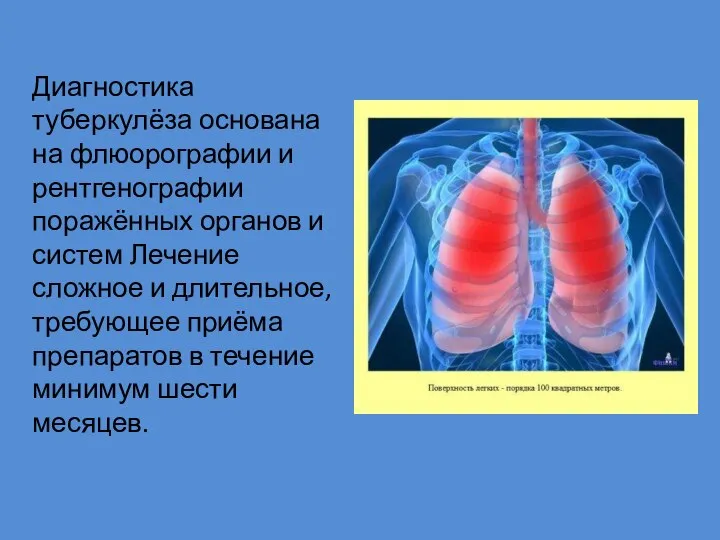 Диагностика туберкулёза основана на флюорографии и рентгенографии поражённых органов и систем