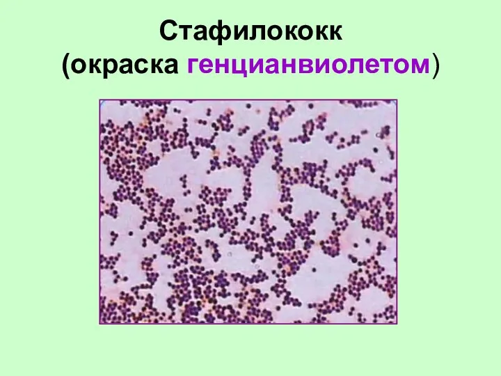 Стафилококк (окраска генцианвиолетом)