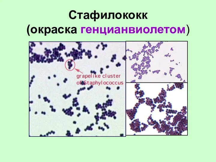 Стафилококк (окраска генцианвиолетом)