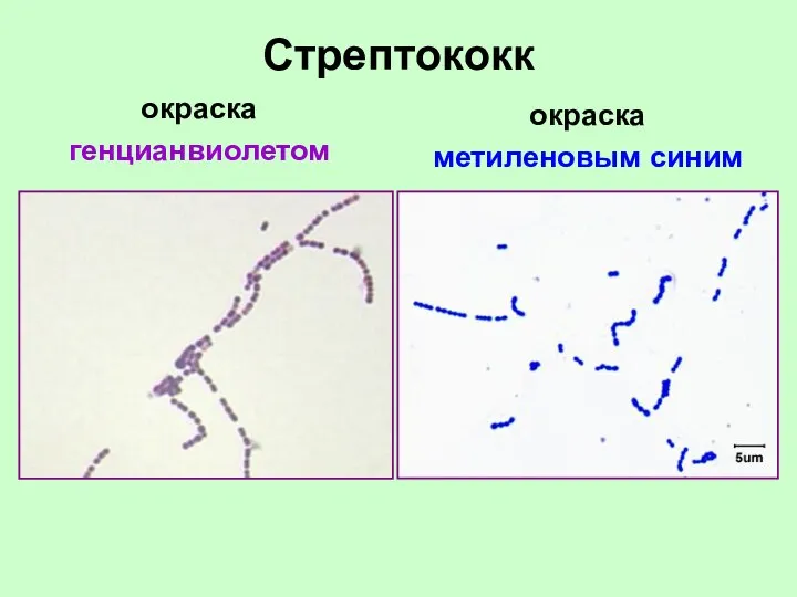 Стрептококк окраска генцианвиолетом окраска метиленовым синим