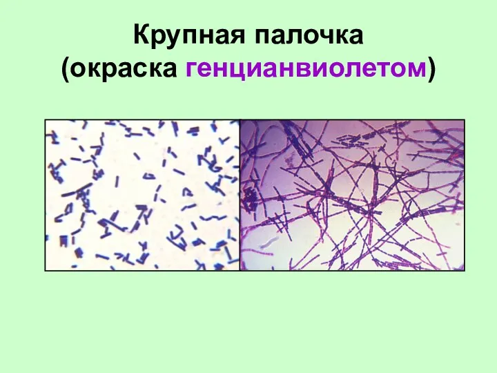 Крупная палочка (окраска генцианвиолетом)