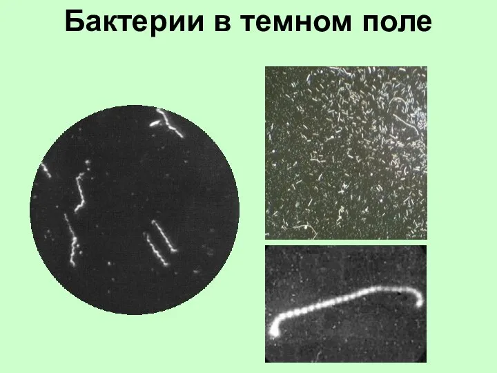Бактерии в темном поле