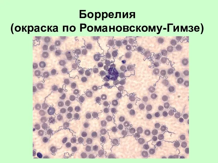 Боррелия (окраска по Романовскому-Гимзе)