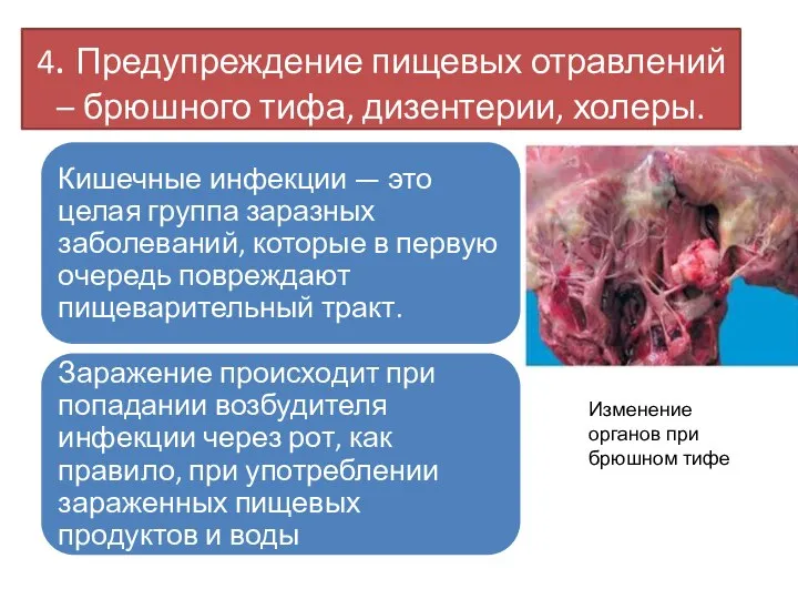 4. Предупреждение пищевых отравлений – брюшного тифа, дизентерии, холеры. Изменение органов при брюшном тифе