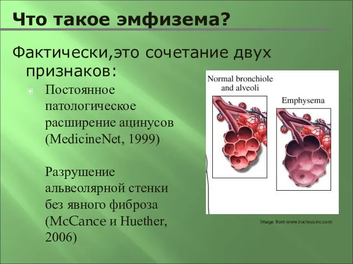 Что такое эмфизема? Постоянное патологическое расширение ацинусов (MedicineNet, 1999) Разрушение альвеолярной