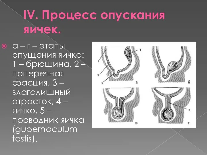 IV. Процесс опускания яичек. а – г – этапы опущения яичка: