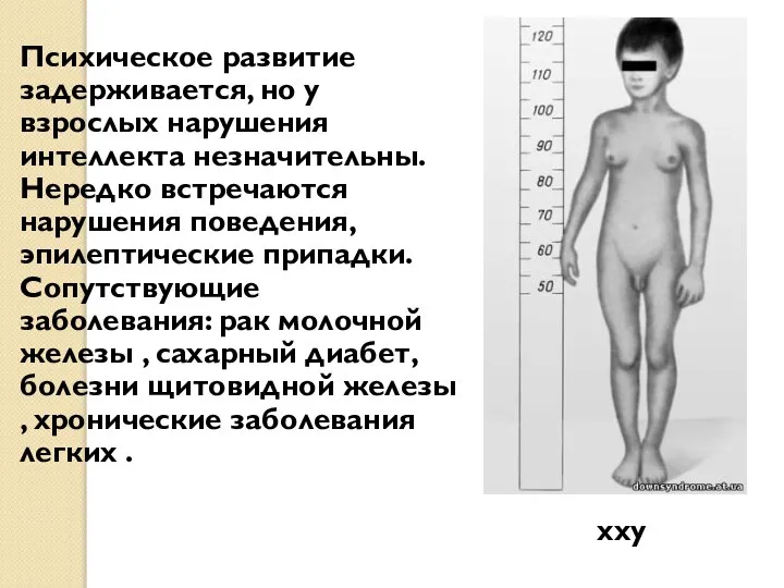 хxy Xхyy ххy Психическое развитие задерживается, но у взрослых нарушения интеллекта