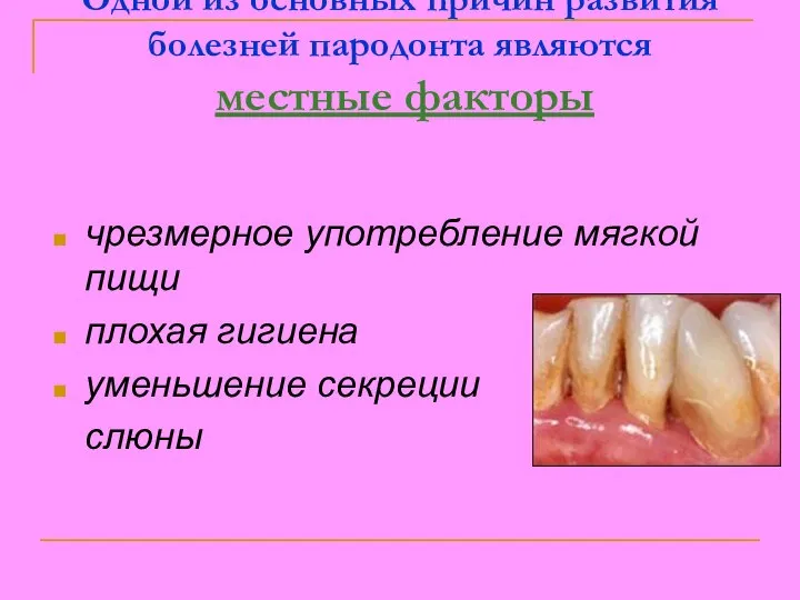 Одной из основных причин развития болезней пародонта являются местные факторы чрезмерное