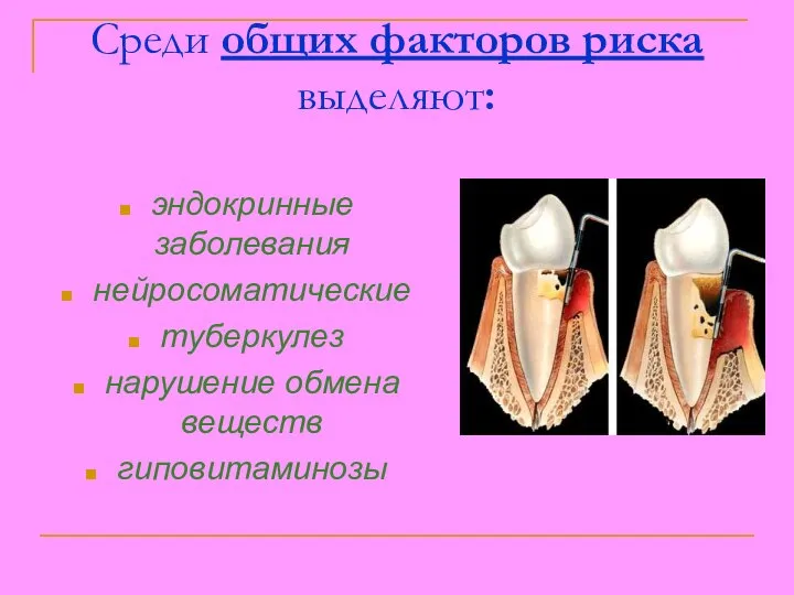 Среди общих факторов риска выделяют: эндокринные заболевания нейросоматические туберкулез нарушение обмена веществ гиповитаминозы