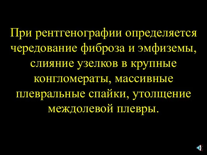 При рентгенографии определяется чередование фиброза и эмфиземы, слияние узелков в крупные