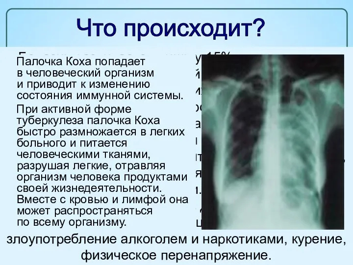 Болезнь развивается лишь у 15% процентов лиц, заразившихся микобактерией туберкулеза. Главной